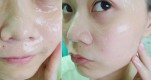 Cứu tinh cho làn da khô, nhiều mụn ngờ đâu lại là nguyên liệu dễ tìm này