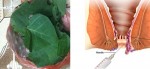 Một nắm lá chữa dứt đến 90% bệnh trĩ dù trĩ dài 1 đốt tay