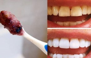 Nghiền nát thứ quen thuộc này chà 2 phút, răng ố cỡ nào cũng trắng bóng khỏi cần đi nha sĩ