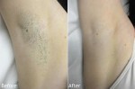 Nách hết thâm, trắng sáng chỉ trong 3 ngày nhờ những nguyên liệu rẻ tiền này