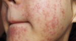 10 thứ tuyệt đối không bôi lên mặt, món thứ 9 chắc chắn làm bạn hụt hẫng