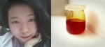 Da mướt mềm trong 2 tuần, chỉ cần 1 phút/ngày, siêu đơn giản ạ!!!