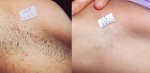 2 công thức từ nhựa hồng xiêm giúp bạn tẩy sạch sành sanh "vi - ô- lông"