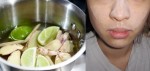 Không cần nặn, cứ làm thế này mụn đầu đen tự khắc chui ra mà chẳng làm giãn lỗ chân lông