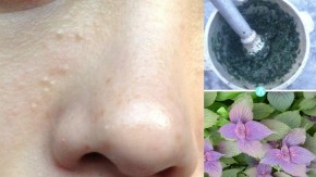 Da trắng căng mướt, sạch mụn nhờ 10 lá tía tô