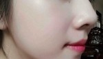 Chỉ cần dùng 2 viên/ngày, cả đời không cần mua mỹ phẩm, lỗ chân lông được se khít 100%
