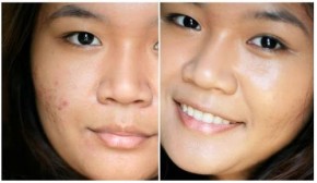 Tự làm mặt nạ loại bỏ nếp nhăn, sẹo mụn, làm trắng da chỉ sau 2 lần sử dụng