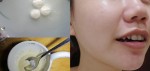 Da căng mịn, mụn ẩn tự trồi lên rồi không còn 1 cái chỉ nhờ vài viên aspirin nghiền nhuyễn