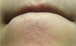 Xóa sổ mụn li ti, mụn ẩn, se khít lỗ chân lông với lọ nước thần thánh 10/10 người thành công