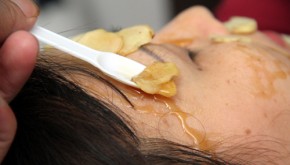 Thái gừng thành lát mỏng rồi đắp lên tàn nhang liên tục sau 15 ngày để da trắng sáng