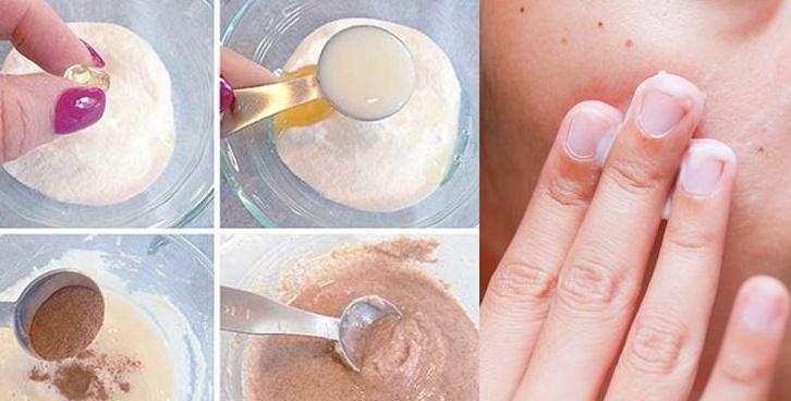 Thêm 2 viên vitamin E vào mật ong rồi thoa lên mặt, da căng mịn chỉ sau 1 đêm