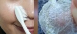 Trước khi vứt bàn chải đánh răng cũ vào sọt rác, hãy giữ chúng lại để trị sạch mụn đầu đen trước đã