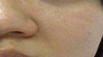 Cách se nhỏ lỗ chân lông to hiệu quả không kém các loại kem đắt tiền