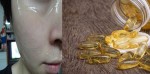 2 viên vitamin E/ngày dùng để đắp mặt, bạn sẽ tiếc “đứt ruột” vì không biết đến điều này sớm hơn