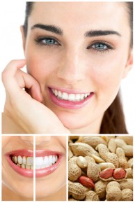 3 cách làm trắng răng an toàn, hiệu quả được nhiều người lựa chọn