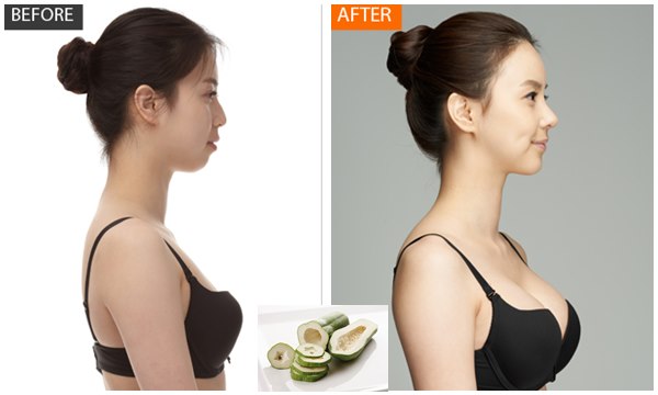 Tăng tức tốc 5 cm vòng một chỉ sau vài lần uống nước đu đủ xanh