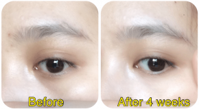 Thực hiện động tác này 2 phút/ngày, mắt sẽ không còn bị chùng và nhăn nữa