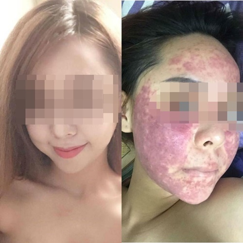 Nghệ được biết là thần dược thần đẹp, nhưng cứ dùng kiểu này thì sẽ nhận lấy hậu quả khôn lường
