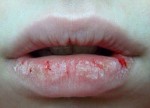 Dùng hỗn hợp này 2 lần/ngày, môi thâm đen khô nứt cũng hồng hào hơn hẳn sau 14 ngày