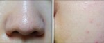 Lỗ chân lông to đến mấy cũng không bao giờ to trở lại khi đã thuộc lòng 6 mẹo này
