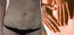 Da bụng xập xệ bao nhiêu cũng săn chắc như gái 18, 20
