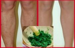 1 tuần dùng ngải cứu theo cách sau, chân chi chít sẹo thâm do muỗi đốt cũng phải trắng sáng ngay tức khắ
