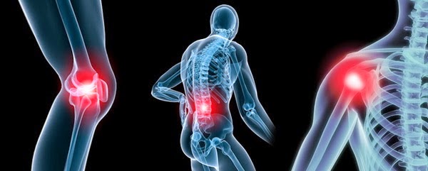 Những món ngon và thói quen khiến xương bị tàn phá nhanh chóng
