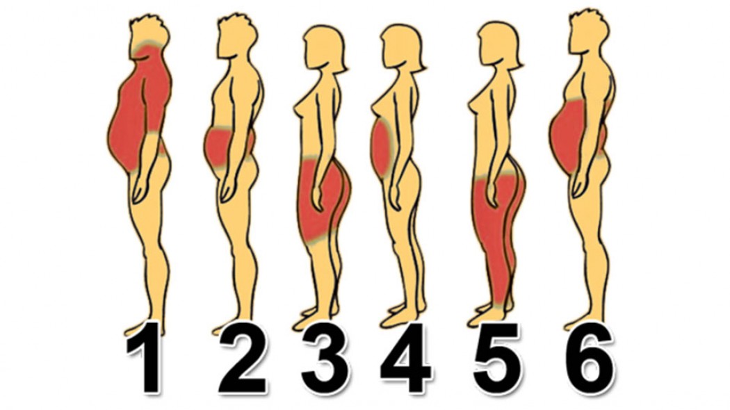Nguyên nhân và cách &rsquo;giải quyết" triệt để từng vị trí tích mỡ khác nhau