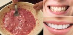 Chà hỗn hợp này lên răng 3 phút và đợi, bạn sẽ bất ngờ về kết quả có được