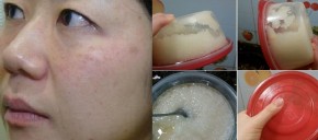 Mấy loại sản phẩm trị nám này các mẹ dùng chưa? Hiệu quả từ gốc luôn đấy!