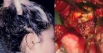 Cẩn thận với những thời điểm gội đầu dễ khiến bạn đột quỵ thậm chí tử vong