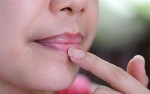 Đã tìm ra "thần dược" cho môi thâm xì thành hồng hào trong tích tắc
