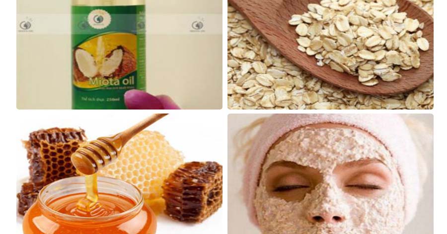 Chỉ cần bôi loại hỗn hợp này mụn lâu năm sẽ tự động biến mất