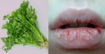 Môi khô nứt chảy máu đau đớn đến đâu cũng phải mềm mại ngay tức khắc với loại rau này