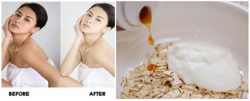 Chỉ bạn cách dưỡng da trắng không còn bắt nắng chỉ với hỗn hợp đơn giản này