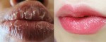 Trị môi khô nứt nẻ trả lại môi CĂNG MỌNG, HỒNG HÀO, QUYẾN RŨ bằng cách vô cùng đơn giản