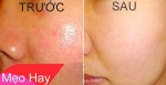 Thật bất ngờ! Cách làm se khít lỗ chân lông chỉ với một quả cà chua