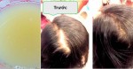 Lấy nước khế chua rồi gội đầu cách này, tóc rụng “kinh niên”, nấm gàu ngứa ngáy cũng phải khỏi ngay