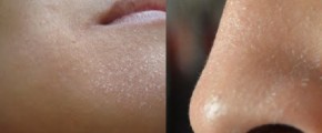 Da khô, mốc hay bong tróc sẽ hết ngay lập tức nếu dùng cách này