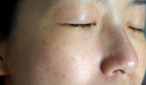 Sản phẩm trị nám HOT mùa Tết của Nhật khiến chị em nội trợ “khen nức nở”, ai cũng phải có