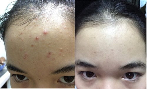 Thoa dầu dừa lên da rồi để qua đêm, rất nhiều cô gái đã phải “mê mệt” với kết quả sau đó