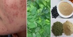 Pha bột đậu với rau ngót rồi uống, mụn nào cũng ra đi vĩnh viễn chớp nhoáng chỉ sau 1 tuần