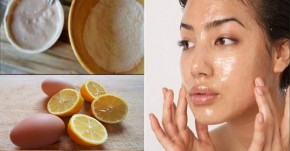 5 loại kem dưỡng ẩm tự nhiên mùa hanh khô tốt hơn vạn mỹ phẩm dưỡng da