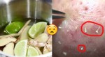 Làm mụn đầu đen "tự trồi lên" rồi dùng nhíp gắp ra ‘dễ ợt’ nhờ 1 nửa quả chanh