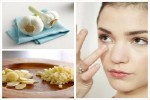 Mụn ẩn trên trán, dưới cằm và 2 bên má sẽ "không cánh mà bay" sau 2 tháng nhờ cách này