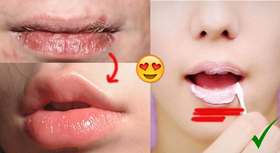 “Học lỏm” người Hàn công thức mặt nạ cho môi HỒNG TƯƠI, CĂNG MỊN cực hiệu quả