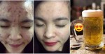 Dẹp mỹ phẩm đi, MỤN TỰ CHUI RA, DA TRẮNG LÊN RÕ RỆT chỉ với 1 lon bia