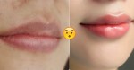 Viền môi, mép thâm đến đâu cũng BIẾN MẤT sau 1 đêm