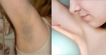 Nách dù thâm đen đến mấy cũng trắng sáng như trứng gà bóc nhờ mặt nạ khoai tây