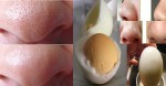 Mụn chi chít cũng biến mất chỉ trong 10 phút nhờ quả trứng luộc